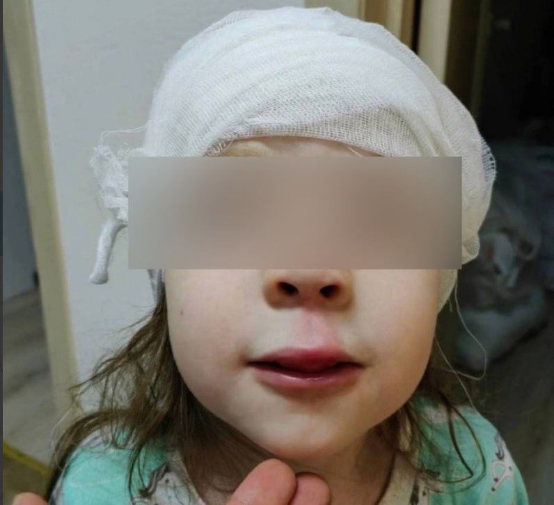 Пятилетняя девочка побила. Пятилетняя девочка побила